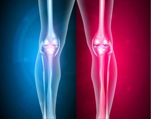 strukturální nebo funkční problémy kolen